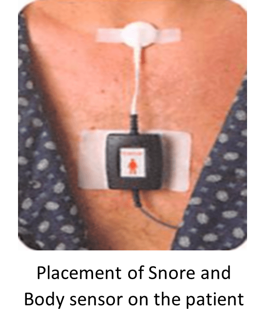 Sleep Test / Sleep Study Singapore l Dr Kevin Soh