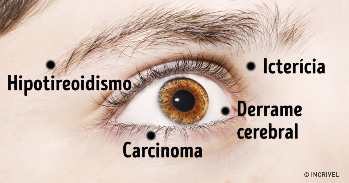 What Is Vision Sense In Human Being;4 Facts You Must Know