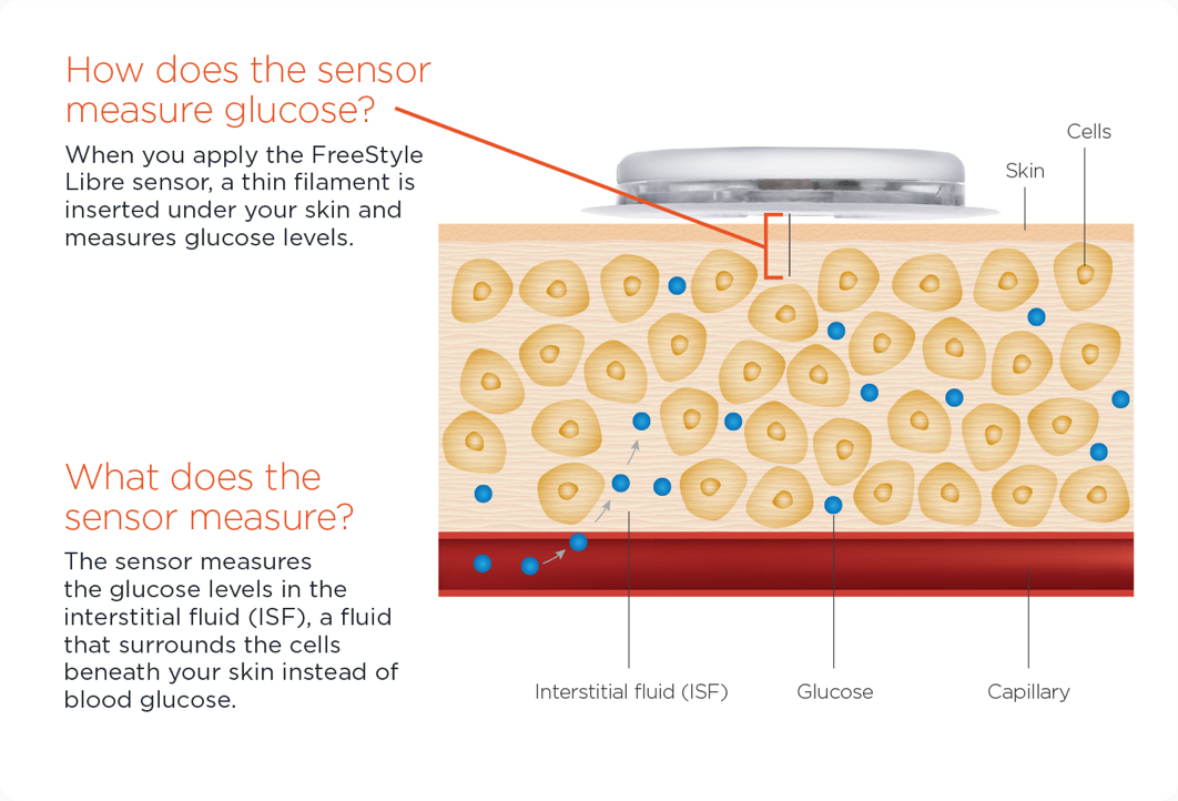 How does Freestyle Libre Work Amazing Features Explained