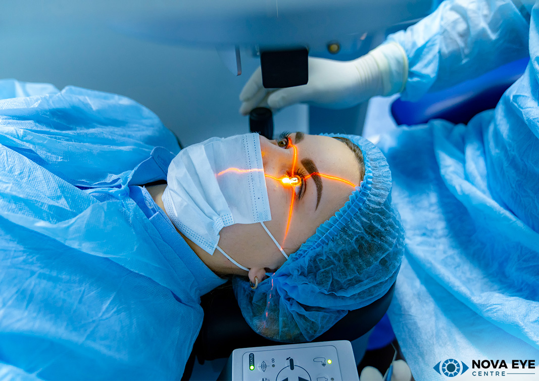 Understanding DCR Surgery Nova Eye Centre