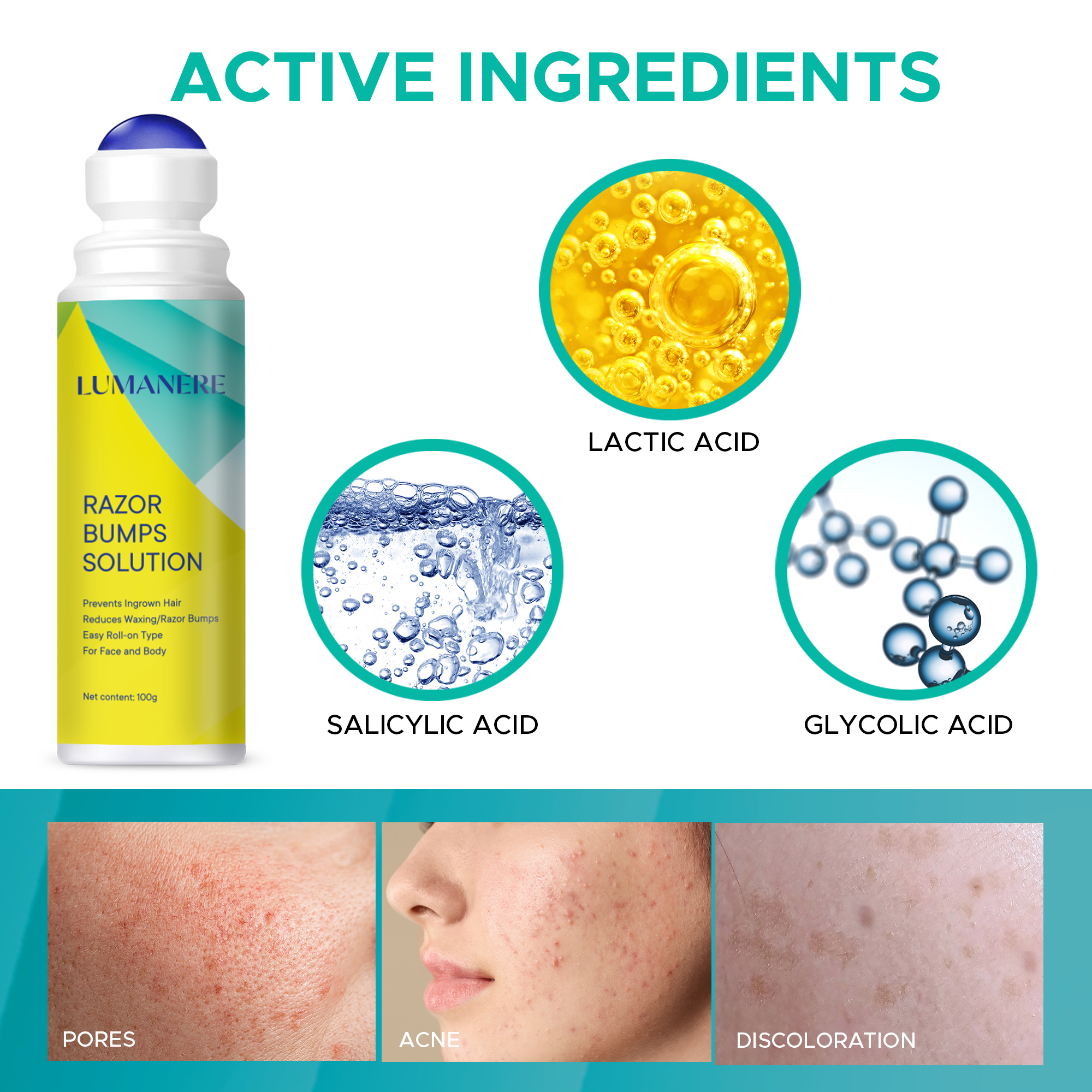 Novapholia Razor Bumps Solution for Ingrown Hair, Razor Bump Treatment