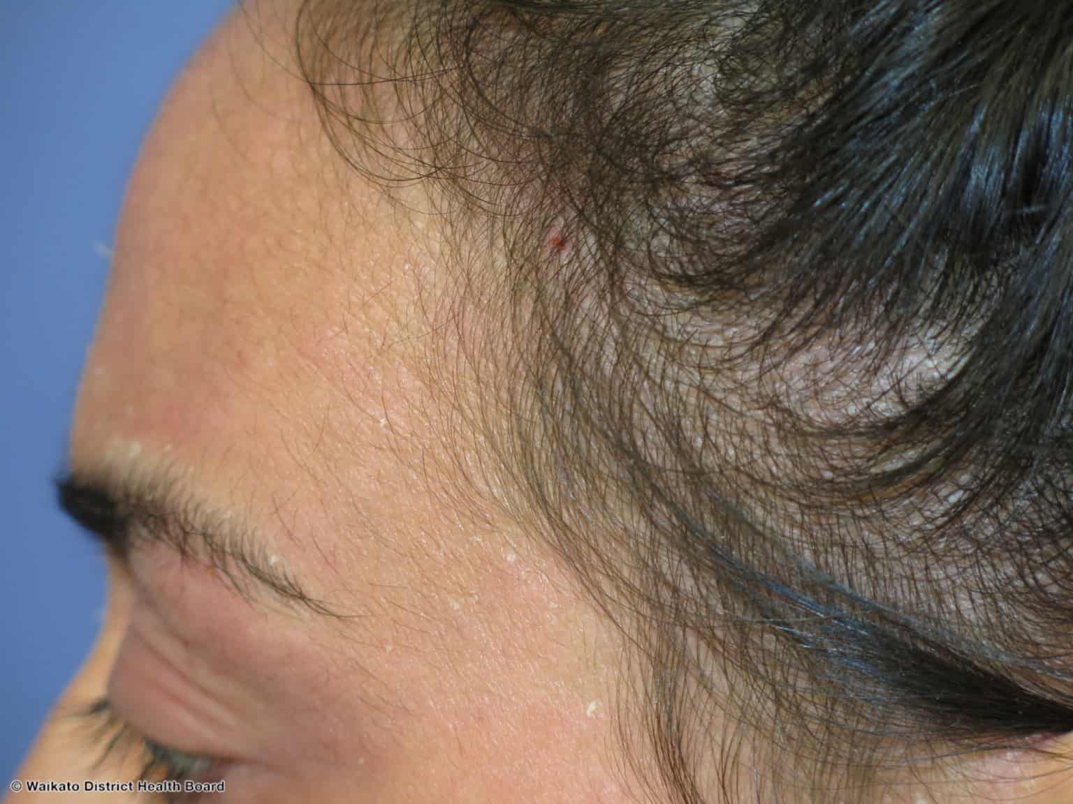 Hair Loss Evaluations Hair Loss Evaluations
