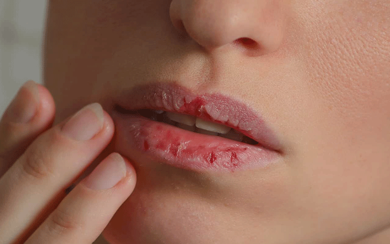 علائم کم آبی بدن را بشناسید. رژیم درمانی نوین