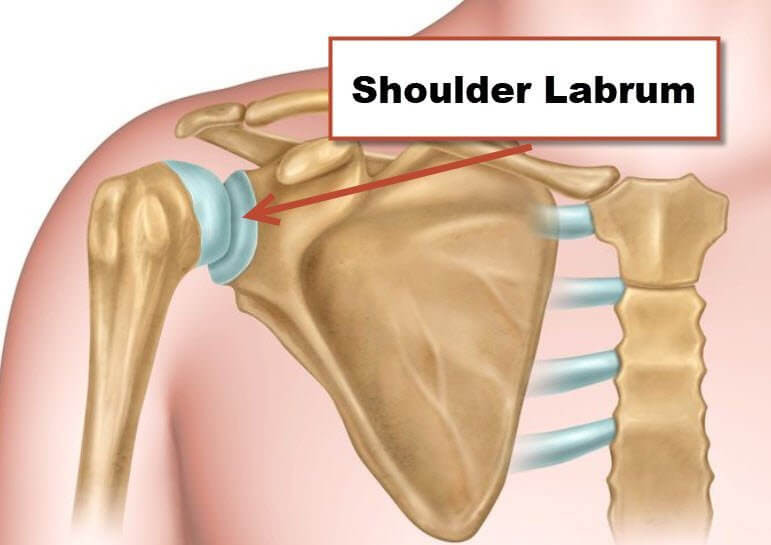 How to Diagnose a Shoulder Labrum Tear Key Signs to Look For Now