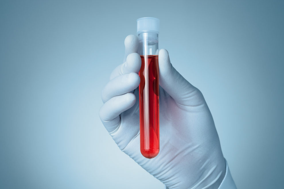 FDA Blood Testing Requirements for Embryo Donors • Embryo Adoption and