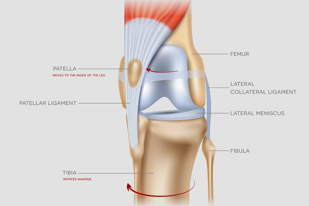 What is Patella Luxation? Northern Rivers Veterinary Specialists