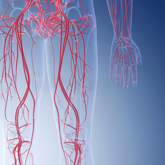 Peripheral Arterial Disease NSVS North Shore Vascular Surgery