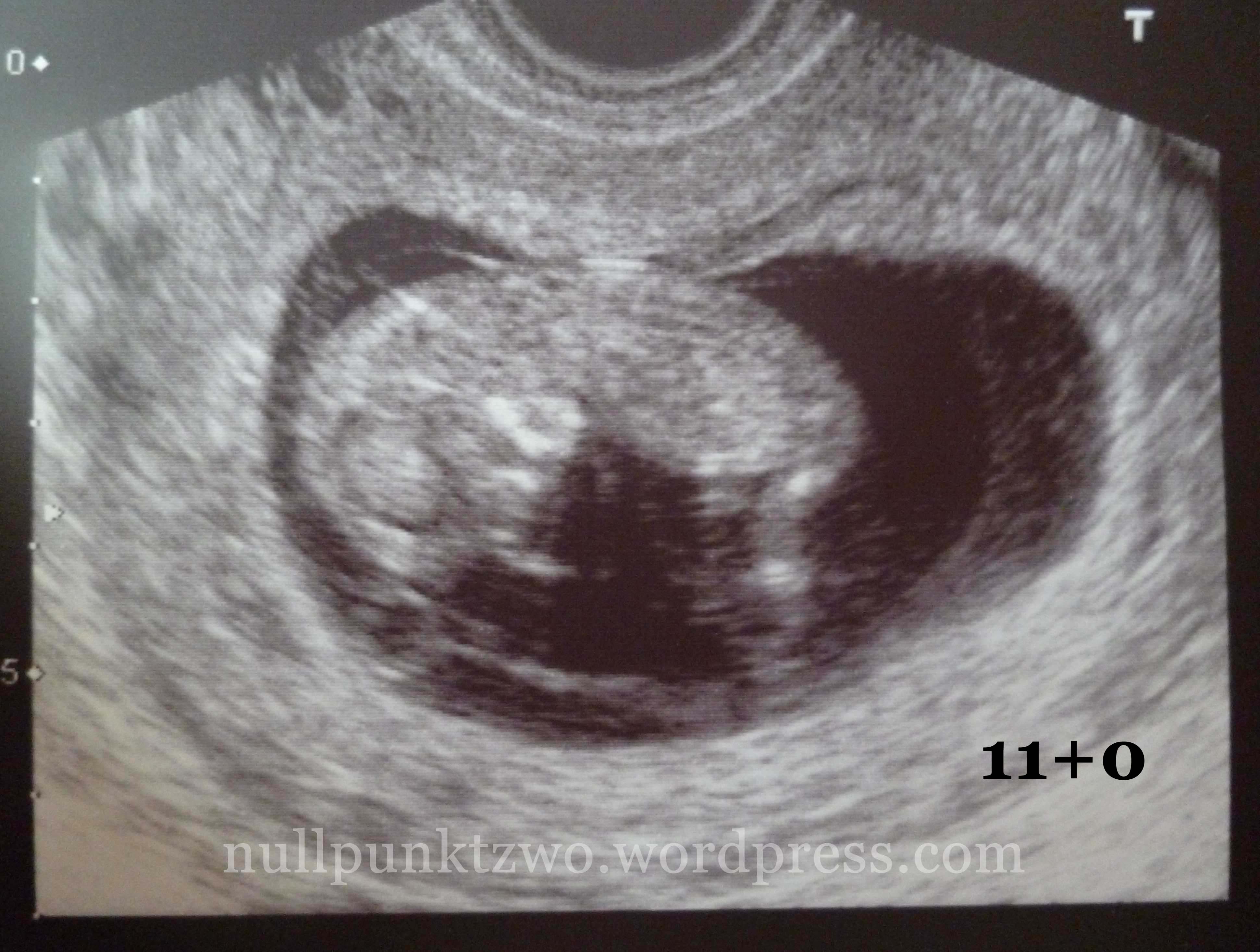 Bauchbilder, Ultraschallbilder und Schwangerschaftstests 2