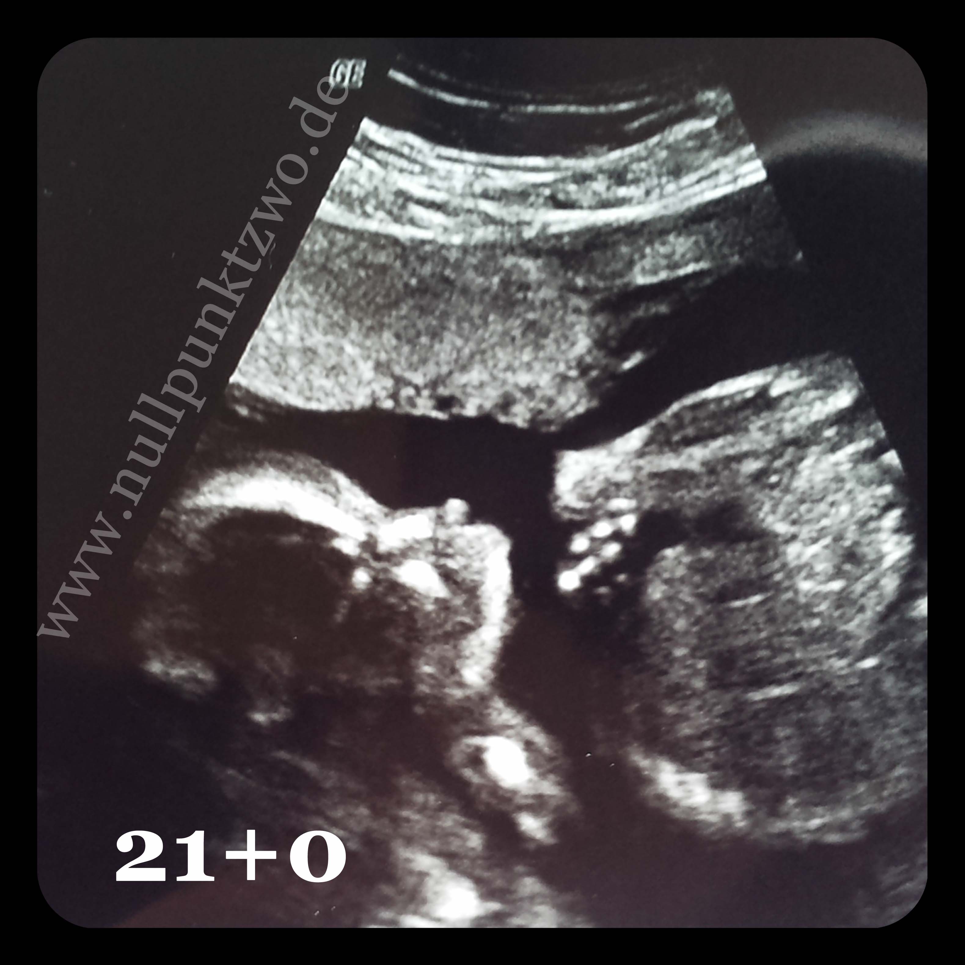 Bauchbilder, Ultraschallbilder und Schwangerschaftstests 3