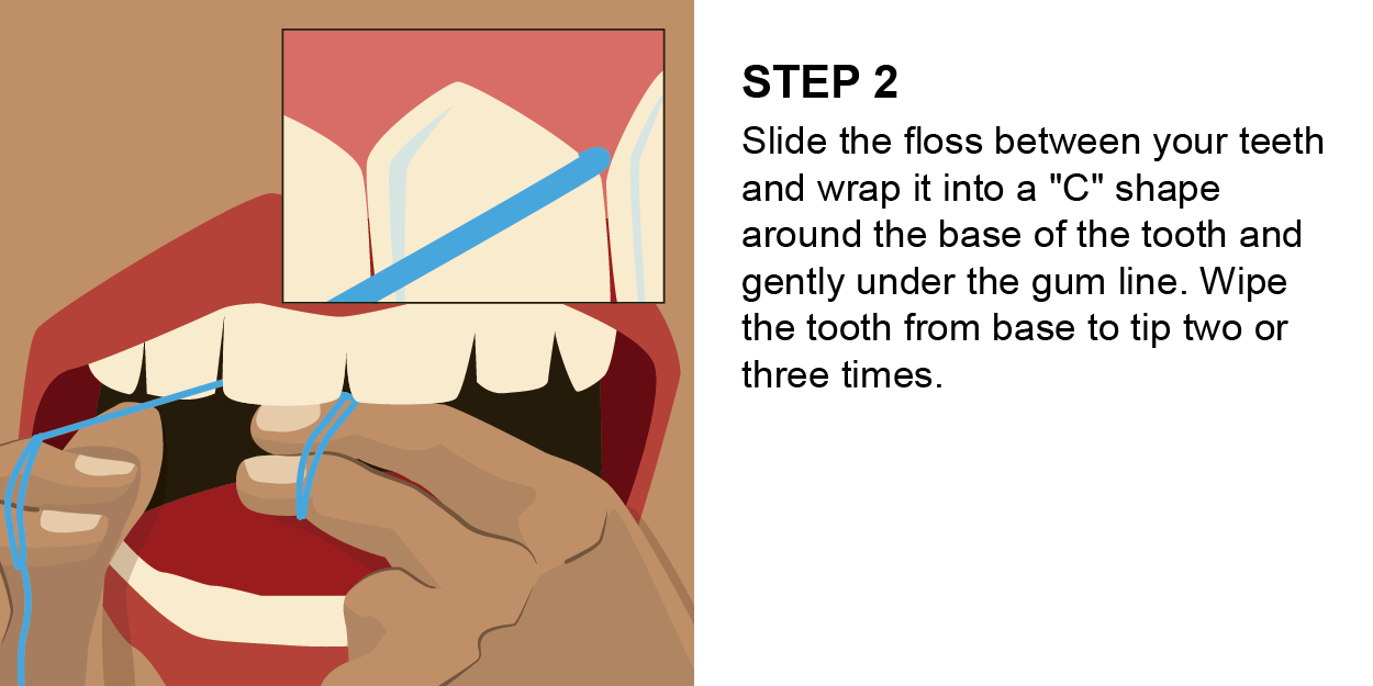 Brushing and Flossing Nunavut Oral Health