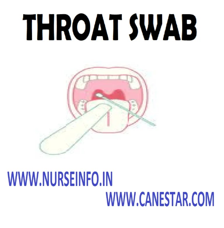 THROAT SWAB PROCEDURE AND COLLECTION