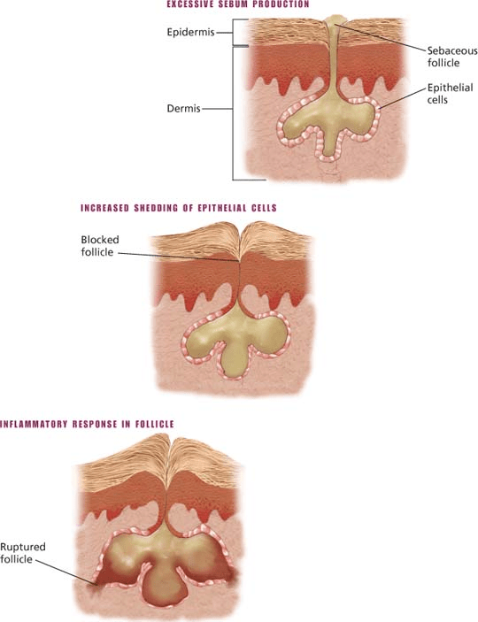 Integumentary care Nurse Key