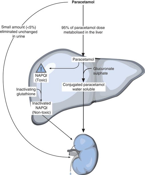 13 DRUG OVERDOSE PARACETAMOL AND SALICYLATE Nurse Key