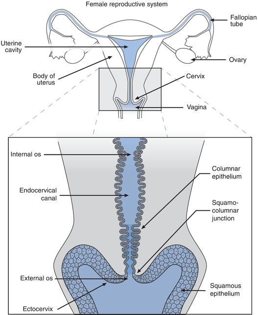 Internal Cervical Os Model Canal