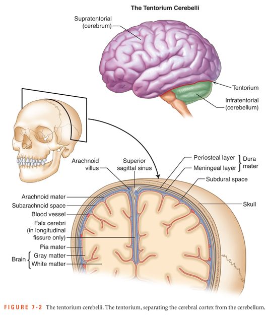 Intracerebral Hemorrhagic Stroke Nurse Key