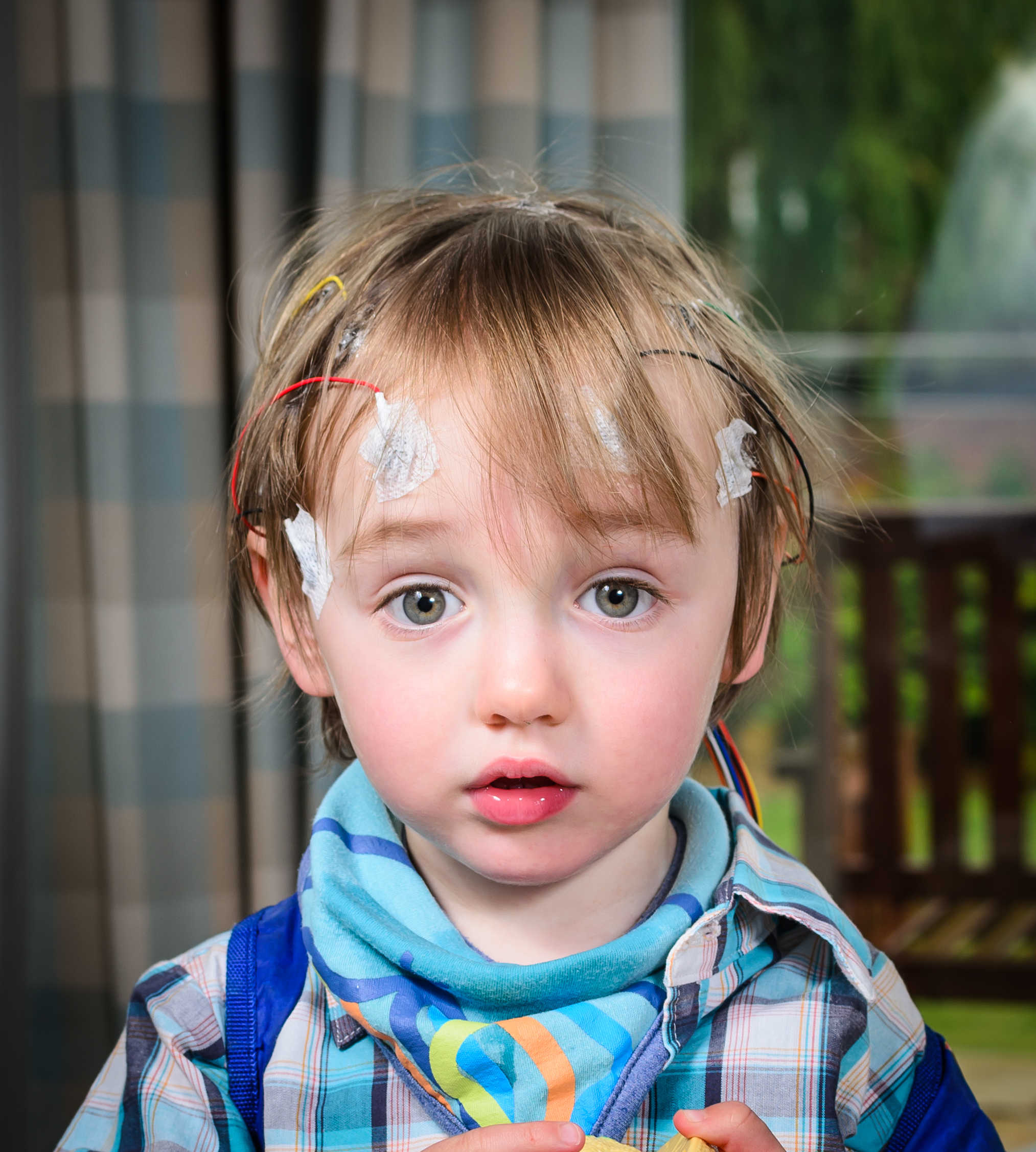 Seizure Disorders (Epilepsy) Nursing Care Management Nurseslabs