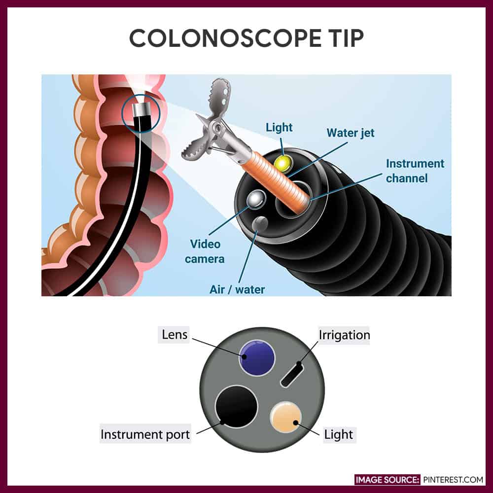 Instrument Used In Colonoscopy