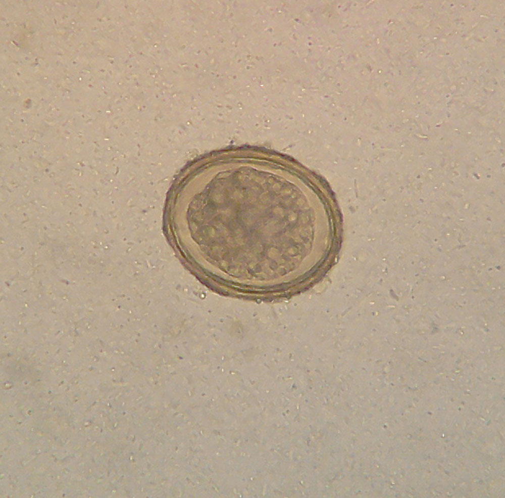 Roundworms (Ascariasis) Nurseslabs
