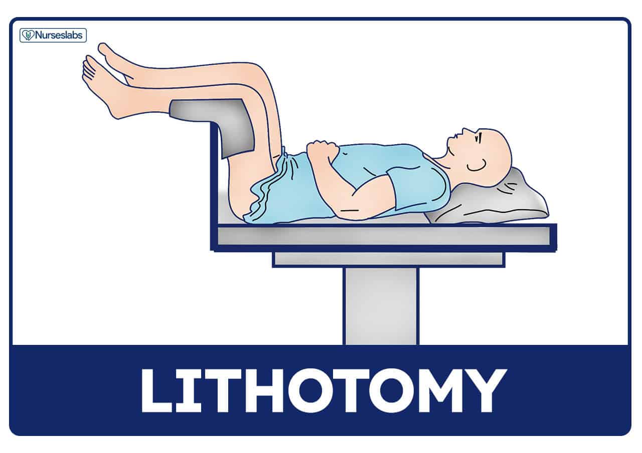 Patient Positioning (Sims, Orthopneic, Dorsal Recumbent) Guide [2020]