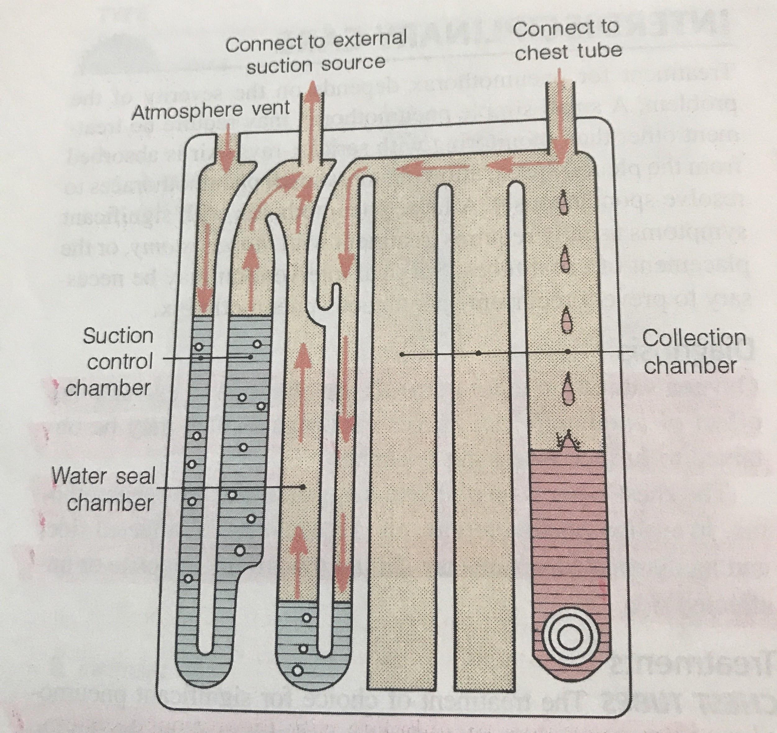 Chest Tubes Nursing Care CEU Nursing CE Central