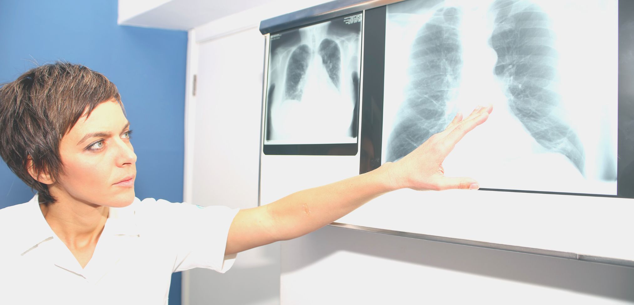 Exploring the Causes and Symptoms of Pulmonary Embolism