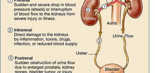 acute renal failure signs Archives Nursing Crib