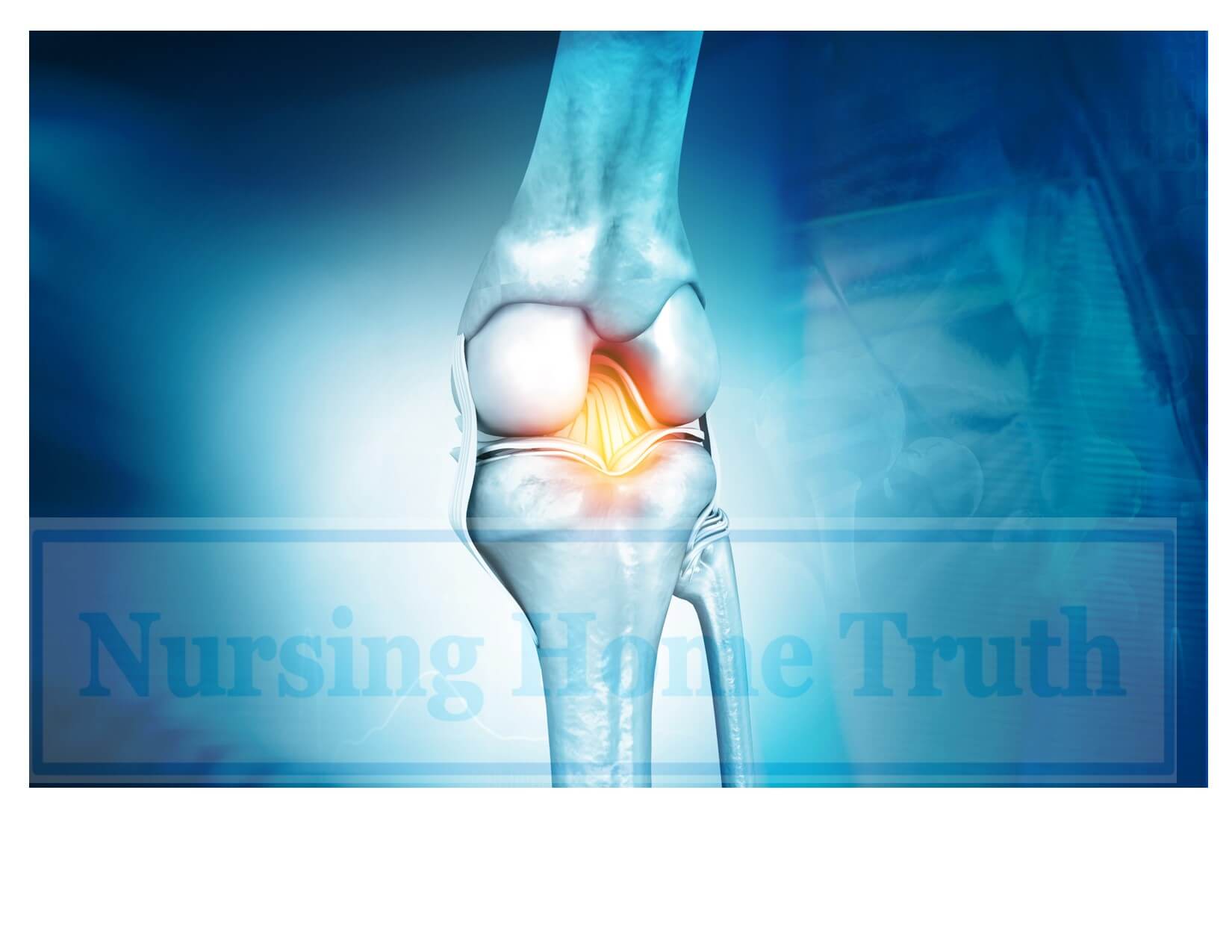 Knee Surgery Verdicts and Settlements ***(2022 Update)***