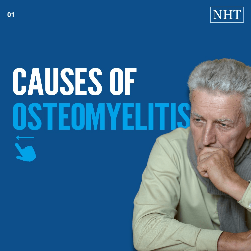 Nursing Diagnosis for Osteomyelitis ***[2023 Legal Update]***