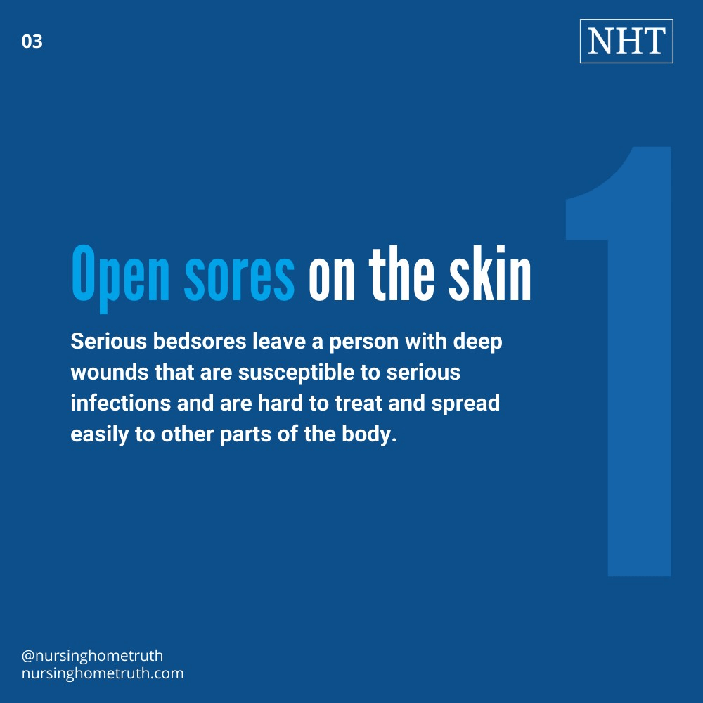 Nursing Diagnosis for Osteomyelitis ***[2023 Legal Update]***