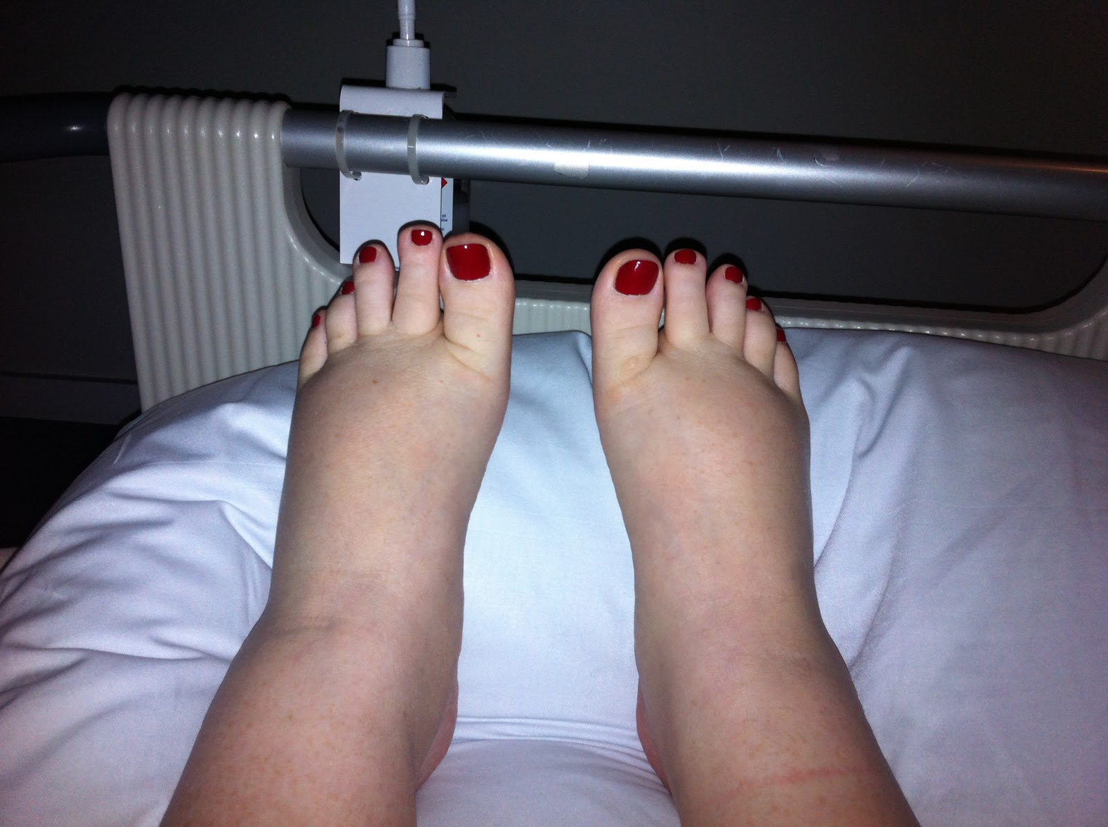 PREECLAMPSIA NURSING LECTURE