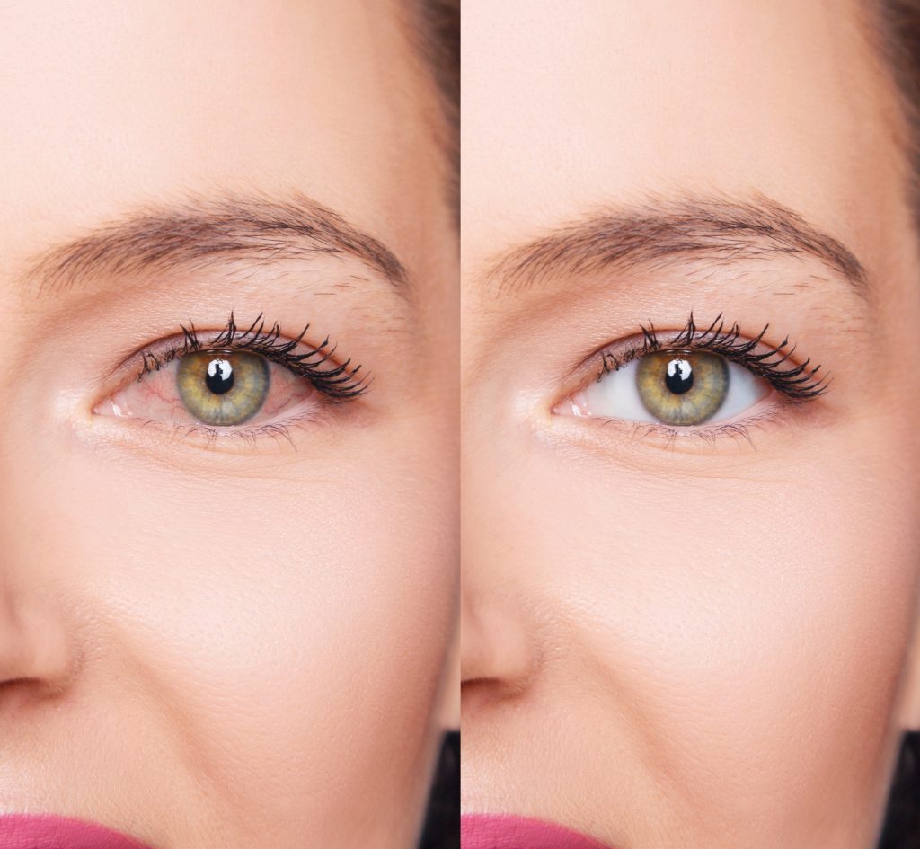  Nutfield Eye Associates