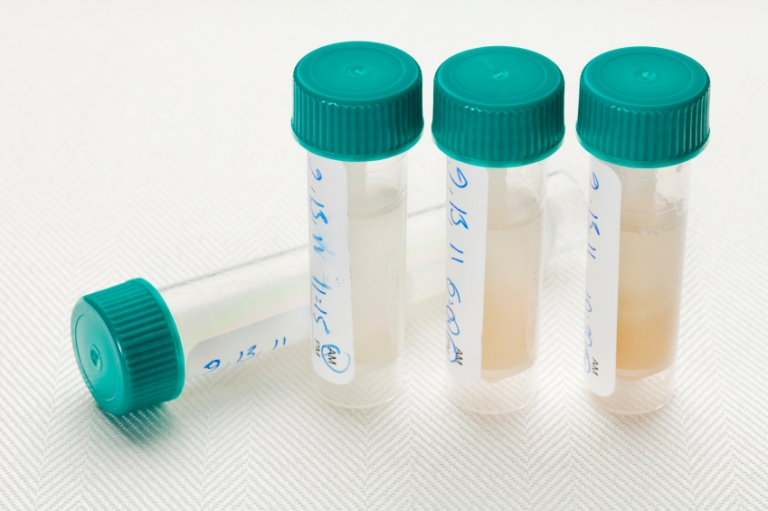 Adrenal Saliva Test (cortisol x4) Nutritionally Yours Test Kits