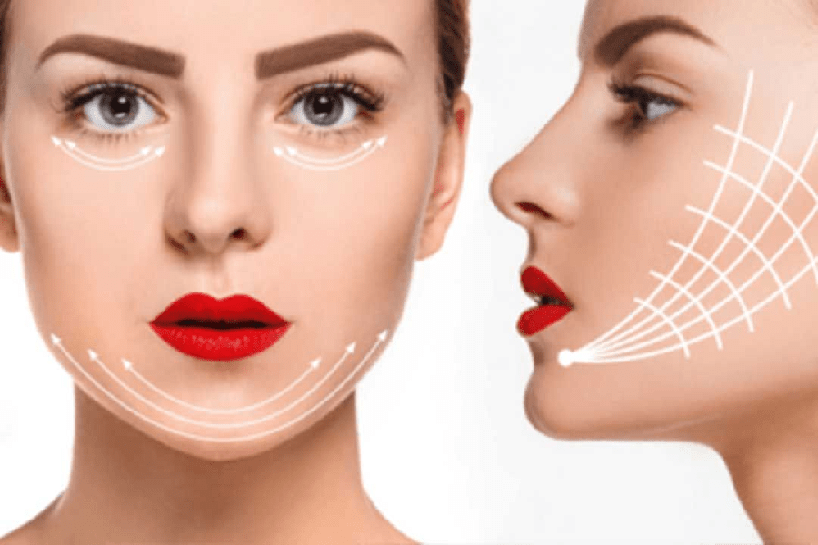 What Is a Vline Jaw Surgery? All About its Treatment and Procedure