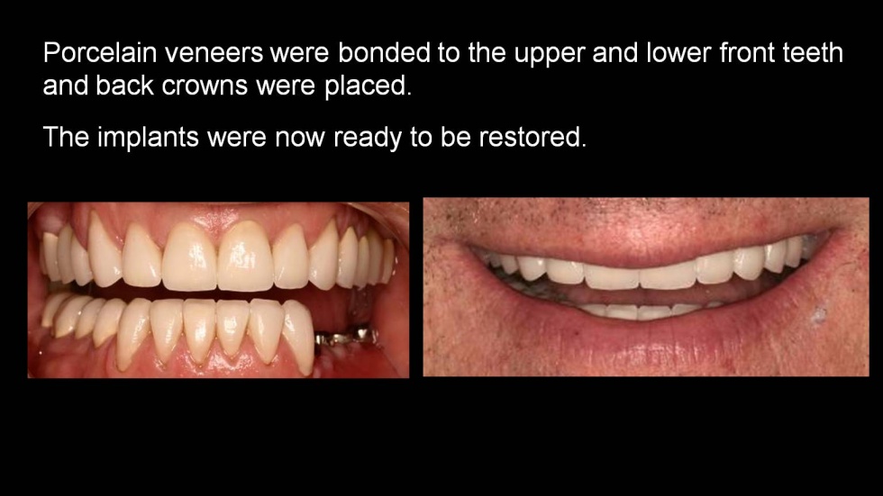 Complex Rehabilitation in Hewlett Hewlett Complex Rehabilitation