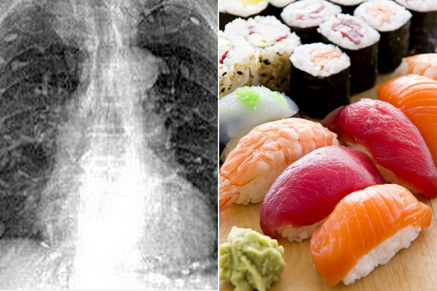 Tapeworms take over man’s body after he eats sushi
