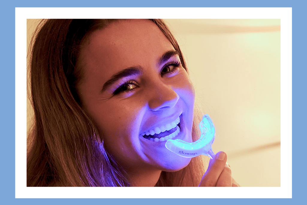 Brighten your smile with these teeth whitening kits on sale now