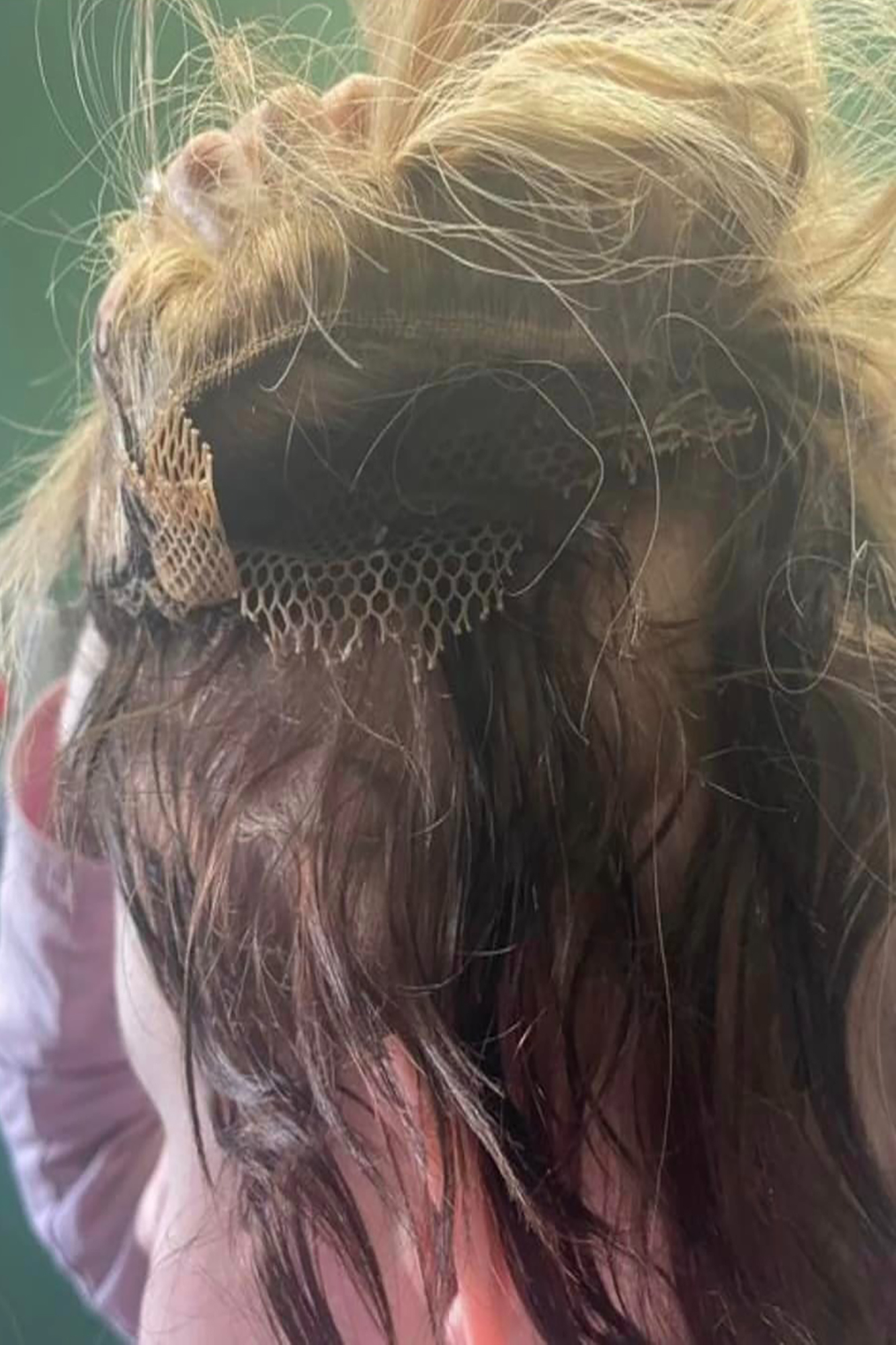 Woman forced to shave her whole head after hair extensions mishap, bald
