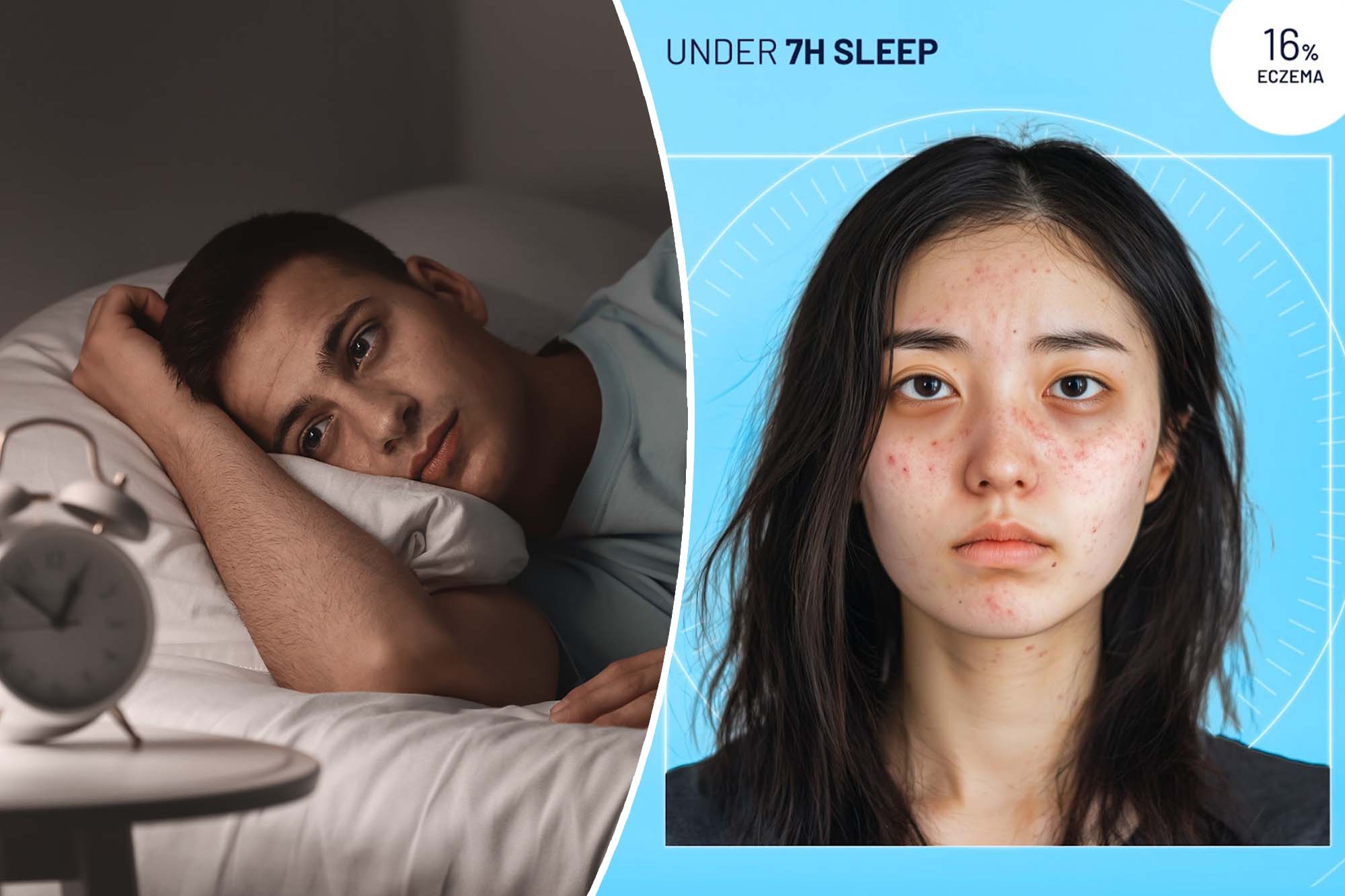 Sleep Deprivation’s Impact on Appearance
