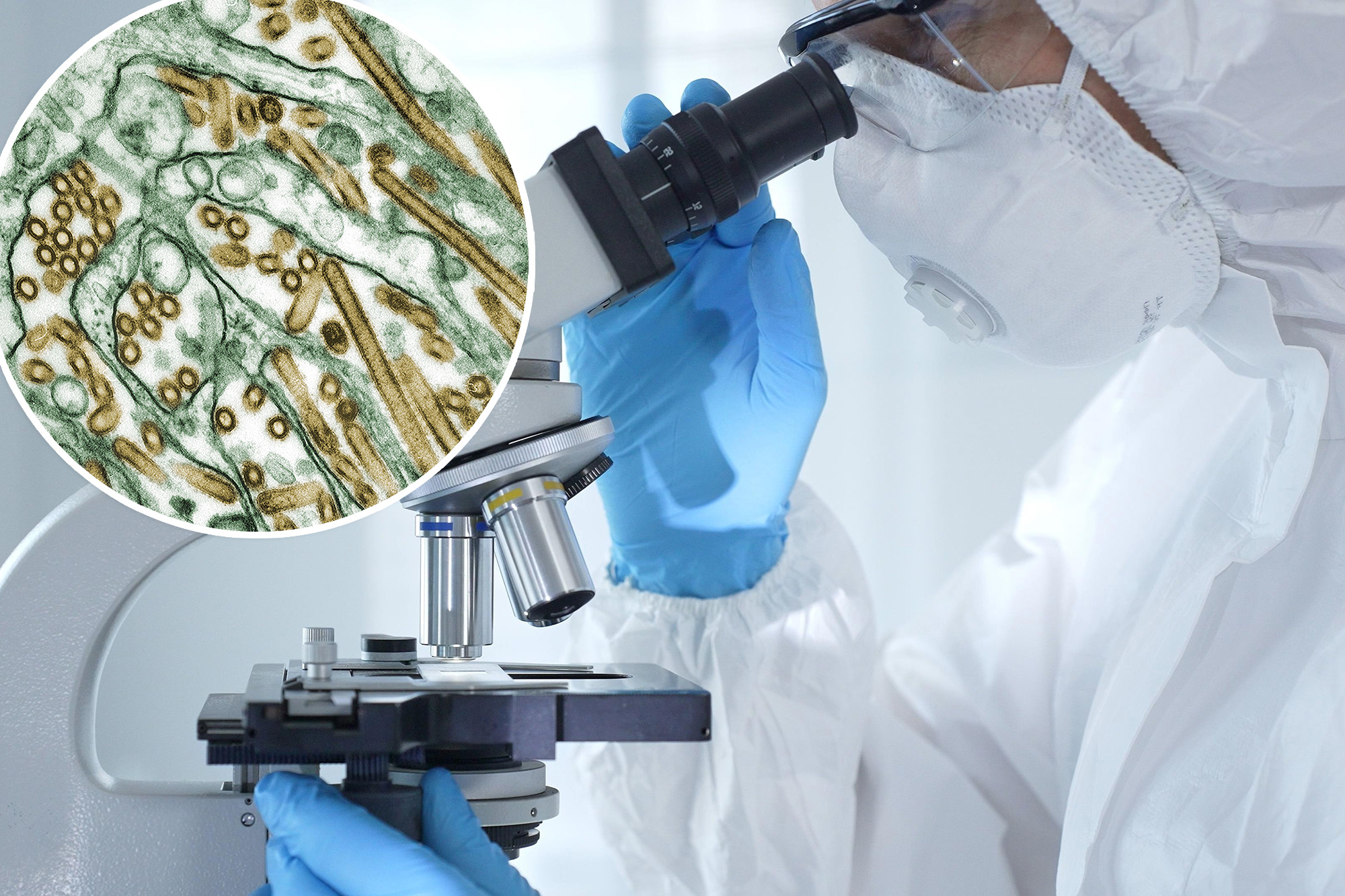Washington man ‘severely ill’ with ‘unpredictable’ virus never before seen in humans