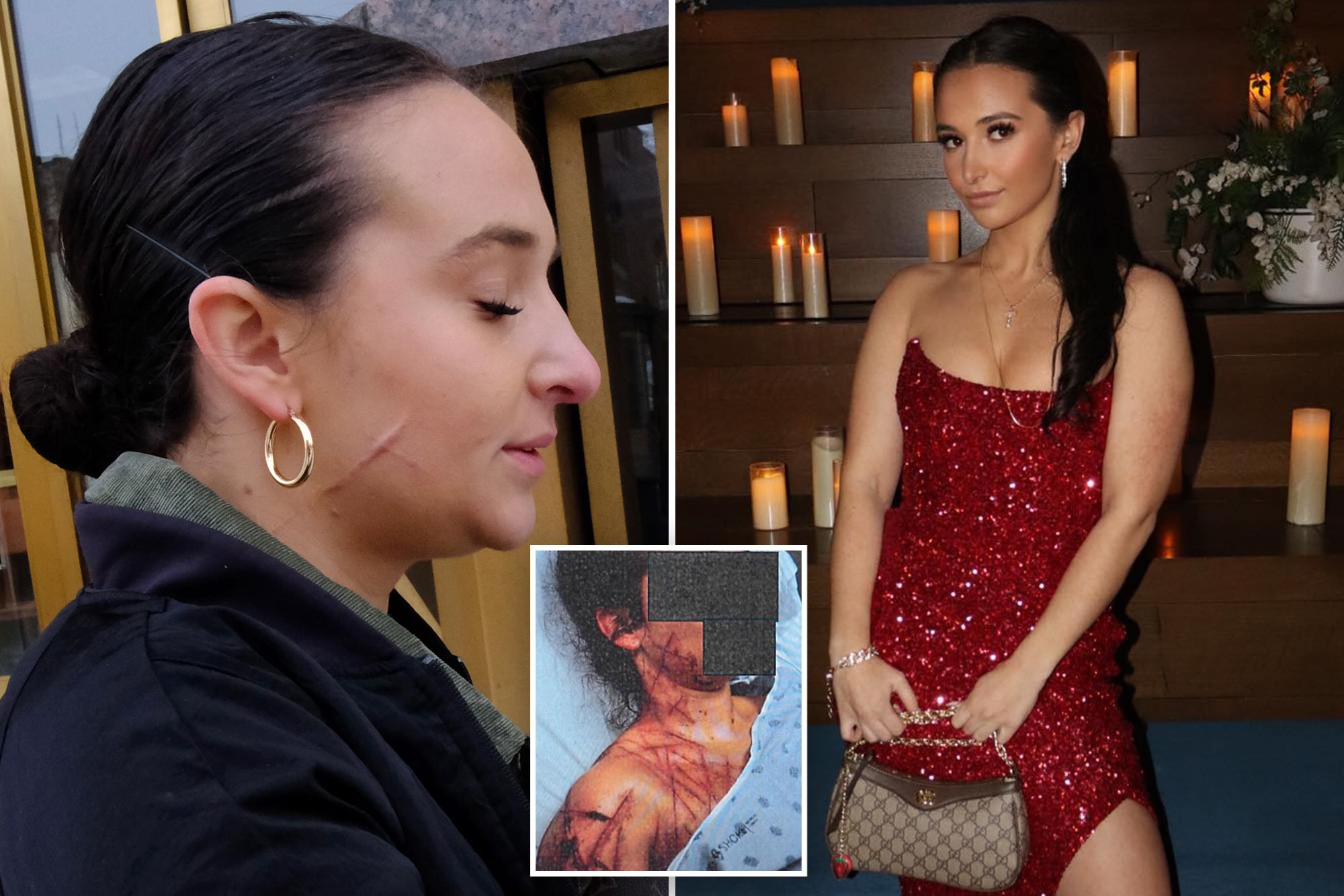 Exclusive | Ex-NJ GOP aide still carries visible scars after she paid fetish artist to carve her up as part of Trump attack hoax