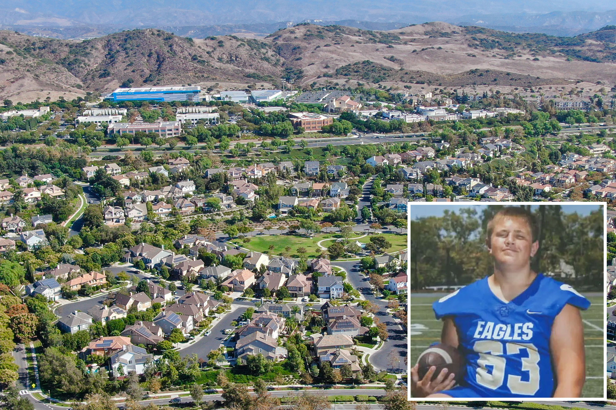 Extremely rare cancer striking kids in rich SoCal city takes worrying turn — as possible cause emerges