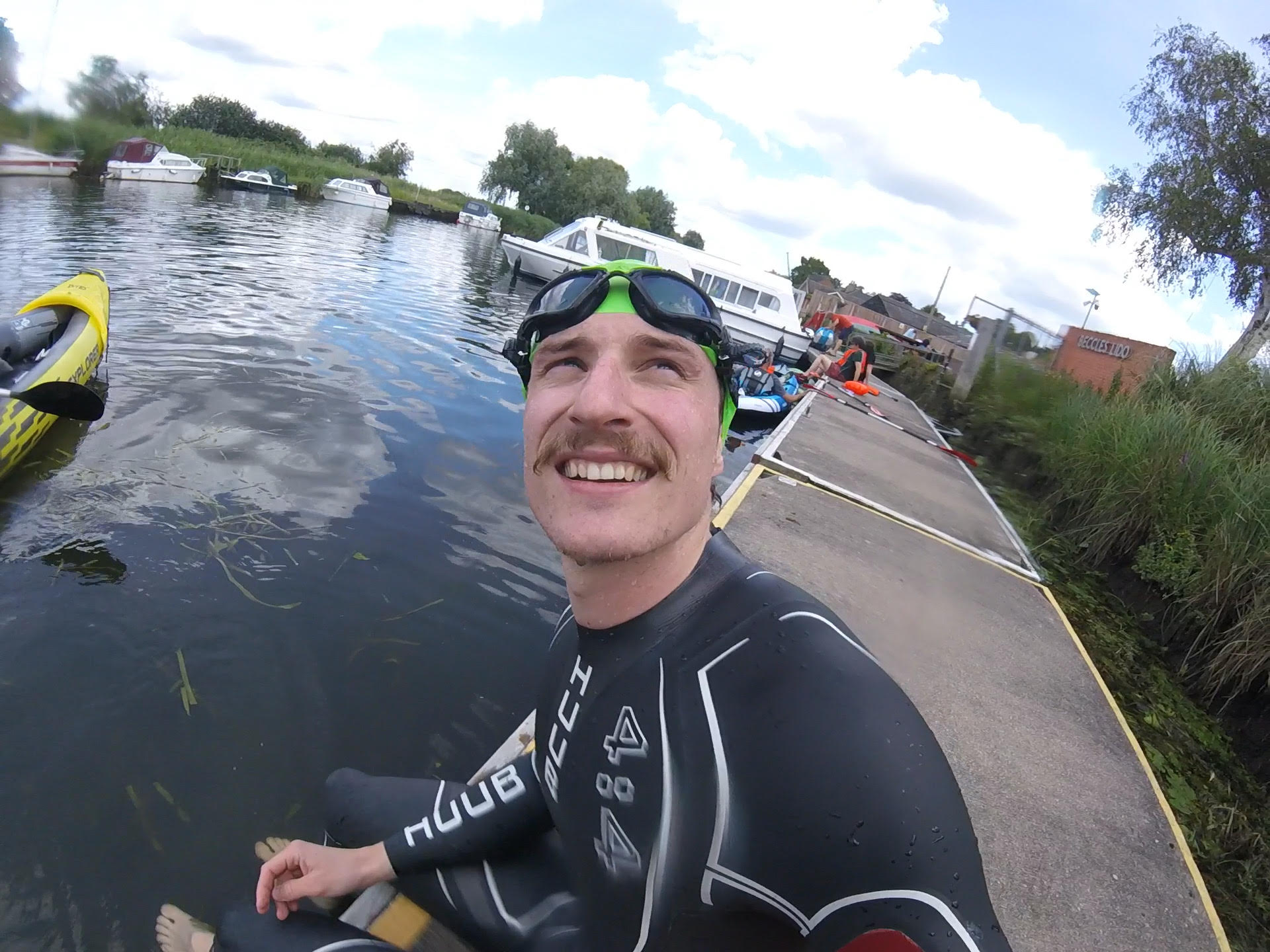 How amazing is Doug? Nystagmus Network