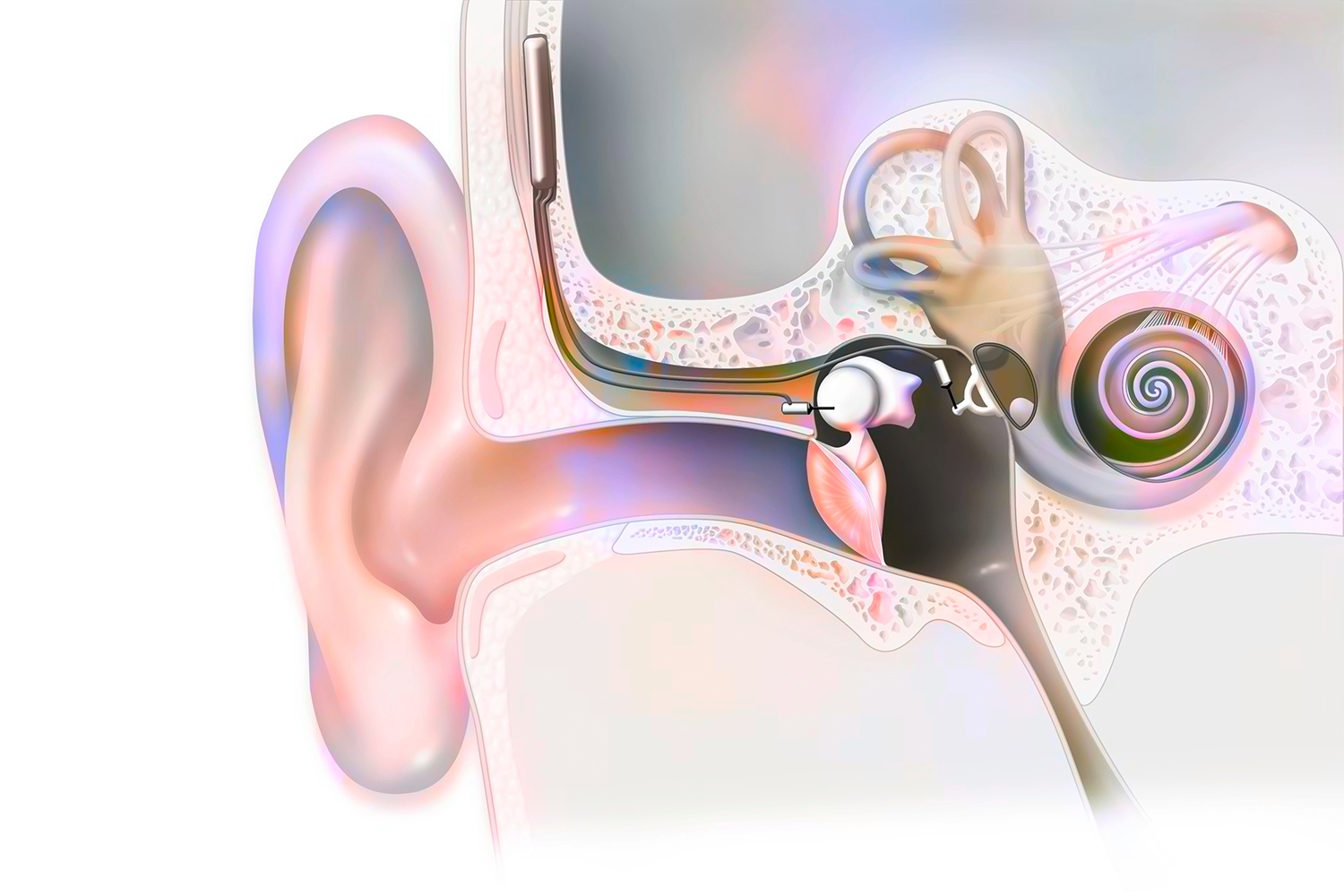 Brain Flexibility Might Speed Up Hearing Improvements from Cochlear