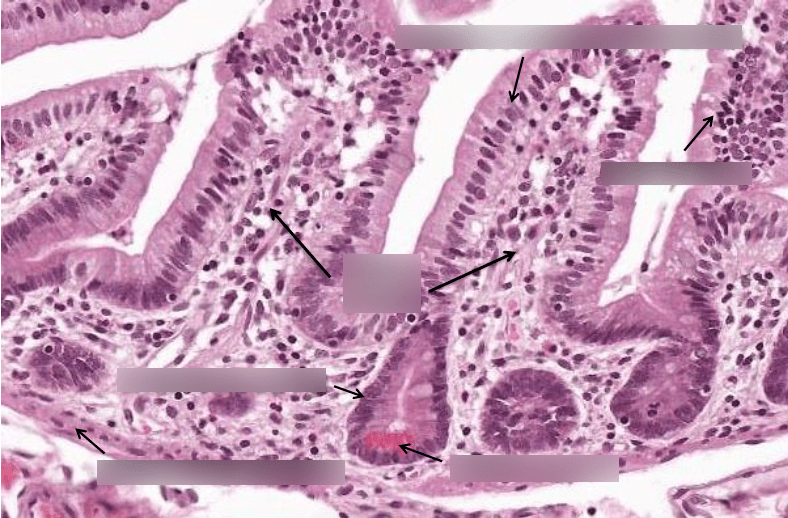 jejunum Diagram | Quizlet