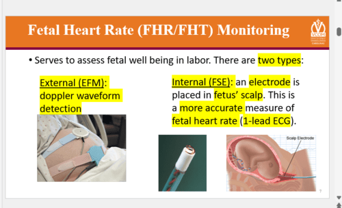 Clin Med 31: INTRAPARTUM CARE III Flashcards | Quizlet