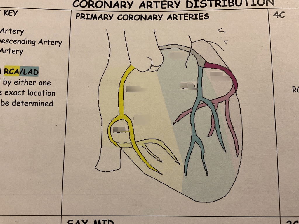 Primary Coronary Arteries Diagram Quizlet