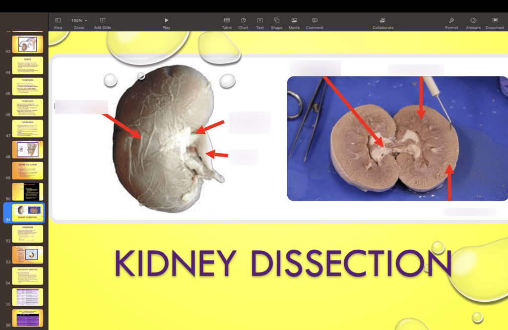 kidney dissection (sheep) Diagram Quizlet