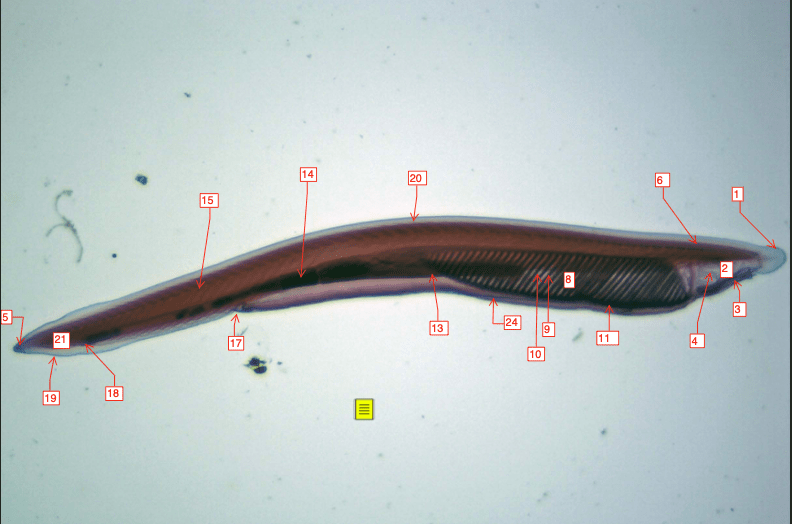 whole mount amphioxus Diagram | Quizlet