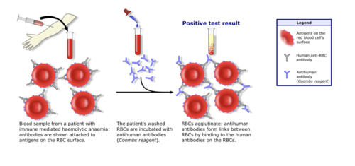 Hematology Quiz Questions And Answers! ProProfs Quiz
