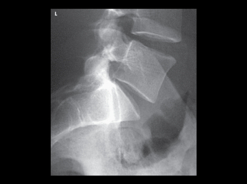 1411 Unit 5 Lateral "Spot" Image Diagram Quizlet